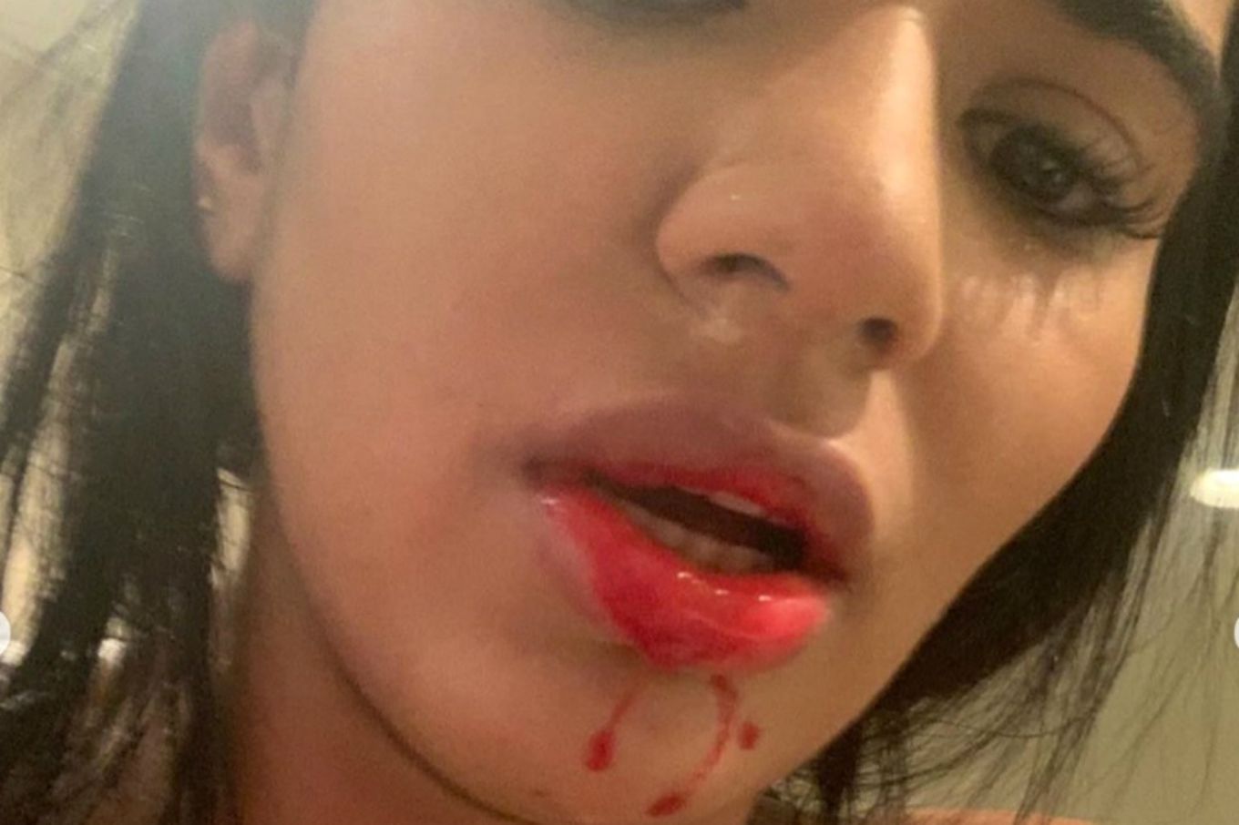 Una de las imágenes que Daniela Cortés subió sobre la agresión recibida